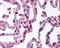Beta-Secretase 2 antibody, 49-611, ProSci, Immunohistochemistry paraffin image 