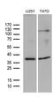 DIMT1 RRNA Methyltransferase And Ribosome Maturation Factor antibody, M14030, Boster Biological Technology, Western Blot image 