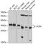 Dicarbonyl And L-Xylulose Reductase antibody, 19-452, ProSci, Western Blot image 