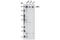 LDL Receptor Related Protein 5 antibody, 3889S, Cell Signaling Technology, Western Blot image 