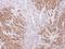 SS-A antibody, NBP1-33548, Novus Biologicals, Immunohistochemistry paraffin image 