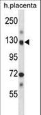 NIMA Related Kinase 9 antibody, LS-C164500, Lifespan Biosciences, Western Blot image 