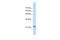 RAS Like Family 10 Member A antibody, 26-637, ProSci, Western Blot image 