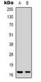 Protein Phosphatase 1 Regulatory Inhibitor Subunit 14A antibody, LS-C368974, Lifespan Biosciences, Western Blot image 