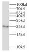Ribosomal Protein L10a antibody, FNab07409, FineTest, Western Blot image 