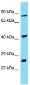 Integrator Complex Subunit 10 antibody, TA337359, Origene, Western Blot image 