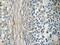 Eukaryotic Translation Initiation Factor 2B Subunit Beta antibody, 11034-1-AP, Proteintech Group, Immunohistochemistry paraffin image 