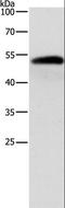 Aldehyde Dehydrogenase 1 Family Member B1 antibody, LS-C402877, Lifespan Biosciences, Western Blot image 