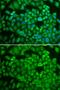 Nuclear Receptor Subfamily 0 Group B Member 1 antibody, GTX54624, GeneTex, Immunofluorescence image 