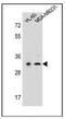 Serine Protease 3 antibody, AP53469PU-N, Origene, Western Blot image 