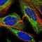 TBC1 Domain Family Member 15 antibody, NBP1-90503, Novus Biologicals, Immunofluorescence image 