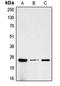 Choriogonadotropin subunit beta antibody, orb213727, Biorbyt, Western Blot image 