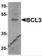 BCL3 Transcription Coactivator antibody, 7183, ProSci, Western Blot image 