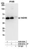 Hydroxyacyl-CoA Dehydrogenase Trifunctional Multienzyme Complex Subunit Beta antibody, A305-021A, Bethyl Labs, Immunoprecipitation image 