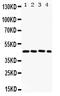 FOS Like 2, AP-1 Transcription Factor Subunit antibody, PB9591, Boster Biological Technology, Western Blot image 