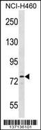 Salt Inducible Kinase 1 antibody, 59-731, ProSci, Western Blot image 