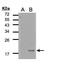 Interleukin 36 Receptor Antagonist antibody, PA5-28818, Invitrogen Antibodies, Western Blot image 