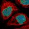 Thymopoietin antibody, HPA008150, Atlas Antibodies, Immunocytochemistry image 