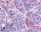 Calcitonin Receptor antibody, LS-A772, Lifespan Biosciences, Immunohistochemistry paraffin image 