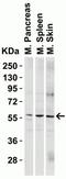 P21 (RAC1) Activated Kinase 2 antibody, NBP1-76721, Novus Biologicals, Western Blot image 