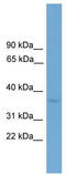 Zinc Finger Protein 444 antibody, TA329949, Origene, Western Blot image 