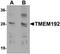 Transmembrane Protein 192 antibody, orb75583, Biorbyt, Western Blot image 