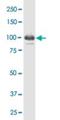 Interferon Gamma Inducible Protein 16 antibody, H00003428-M03, Novus Biologicals, Western Blot image 