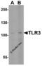 Toll Like Receptor 3 antibody, 3643, ProSci Inc, Western Blot image 