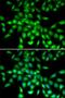 Serpin Family A Member 10 antibody, LS-C346231, Lifespan Biosciences, Immunofluorescence image 