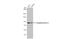 Transglutaminase 2 antibody, GTX111702, GeneTex, Western Blot image 