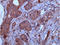 Secreted Phosphoprotein 1 antibody, ADI-905-630-100, Enzo Life Sciences, Immunohistochemistry paraffin image 