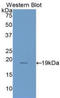 Interleukin 1 Receptor Antagonist antibody, LS-C301553, Lifespan Biosciences, Western Blot image 