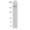 Insulin Receptor Substrate 1 antibody, LS-C381179, Lifespan Biosciences, Western Blot image 