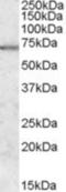 Microtubule Affinity Regulating Kinase 2 antibody, NBP1-00214, Novus Biologicals, Western Blot image 