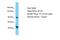 SP100 Nuclear Antigen antibody, PA5-46706, Invitrogen Antibodies, Western Blot image 