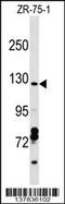 VPS50 Subunit Of EARP/GARPII Complex antibody, 59-254, ProSci, Western Blot image 