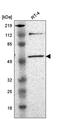 RNA 2',3'-Cyclic Phosphate And 5'-OH Ligase antibody, PA5-64867, Invitrogen Antibodies, Western Blot image 