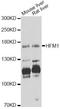 Helicase For Meiosis 1 antibody, LS-C747709, Lifespan Biosciences, Western Blot image 