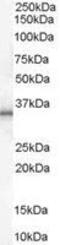 Uncoupling Protein 1 antibody, GTX89371, GeneTex, Western Blot image 