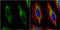 Keratin 14 antibody, GTX104124, GeneTex, Immunofluorescence image 