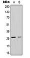 Mitochondrial Ribosomal Protein L17 antibody, LS-C354188, Lifespan Biosciences, Western Blot image 