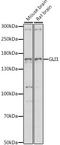 GLI Family Zinc Finger 1 antibody, LS-C749662, Lifespan Biosciences, Western Blot image 