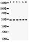 Unc-51 Like Kinase 3 antibody, PB9519, Boster Biological Technology, Western Blot image 