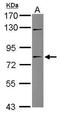 Tigger Transposable Element Derived 1 antibody, GTX107727, GeneTex, Western Blot image 