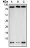 NEDD8 Ubiquitin Like Modifier antibody, orb214300, Biorbyt, Western Blot image 