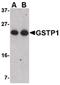 Glutathione S-Transferase Pi 1 antibody, PA5-20462, Invitrogen Antibodies, Western Blot image 