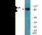 Valosin Containing Protein antibody, EKC2630, Boster Biological Technology, Western Blot image 