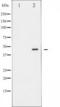 E2F-1 antibody, TA325423, Origene, Western Blot image 