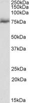 NUMB Like Endocytic Adaptor Protein antibody, EB11530, Everest Biotech, Western Blot image 