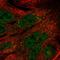 TELO2 Interacting Protein 1 antibody, HPA068338, Atlas Antibodies, Immunofluorescence image 